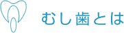 虫歯とは