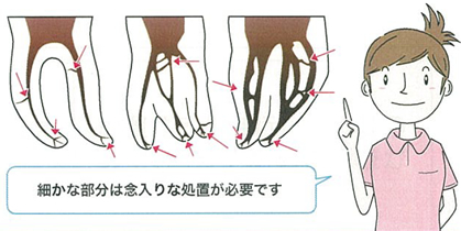 細かな部分は念入りな処置が必要です