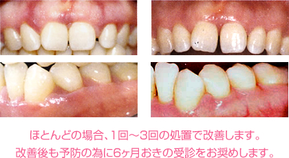 改善後も予防の為に6か月おきの受信をお奨めします